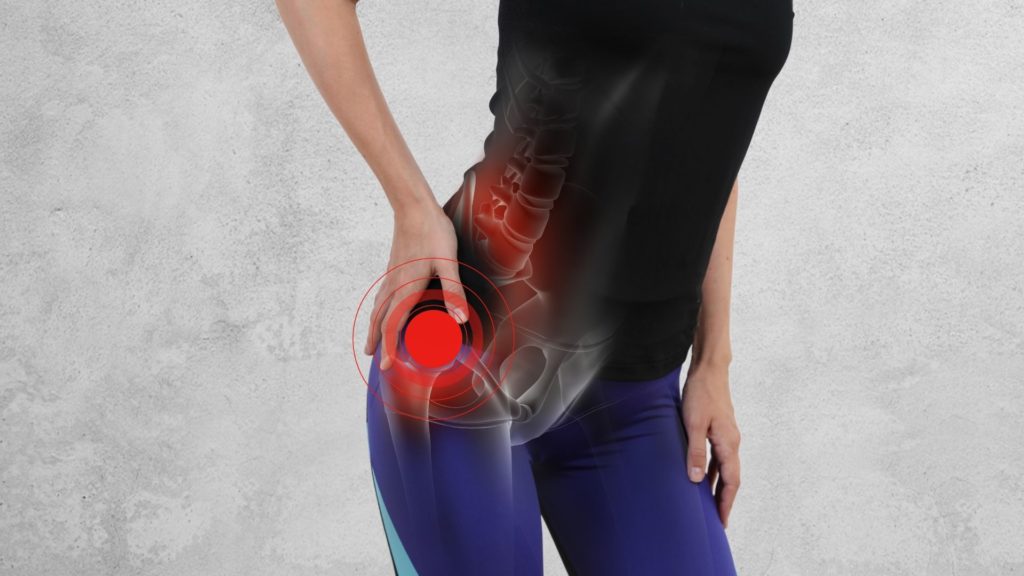I Have Hip Pain What Should I Do? What Causes Impingement Of The Hip?